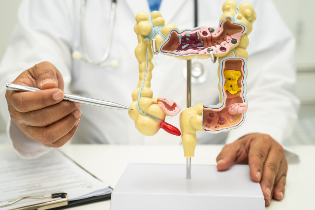 A pesquisa analisou cerca de dois mil voluntários de diferentes estados brasileiros, entre os anos de 2001 a 2020 (Foto: Vecteezy) Imagem: homem mostra peça anatômica de intestino