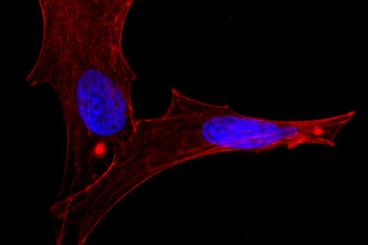 Célula cancerígena, de linhagem PC3 (câncer de próstata), capturada por microscópio confocal, uma das que tiveram seu comportamento mecânico testado (Foto: Divulgação) Imagem de microscópio de célula, de cor vermelha, com dois núcleos azuis, em fundo preto