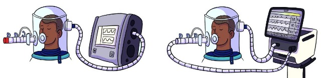 Imagem: Ilustração mostra duas pessoas usando capacete de ventilação não invasiva, conhecido como Elmo, conectado por mangueiras a equipamentos hospitalares. À esquerda, o capacete está ligado a um aparelho menor de ventilação. À direita, o capacete está conectado a um ventilador mecânico maior, com tela exibindo gráficos de monitoramento respiratório.